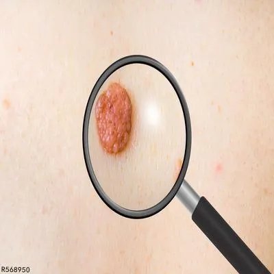 脊索瘤怎么得的 得脊索瘤的具体原因细说