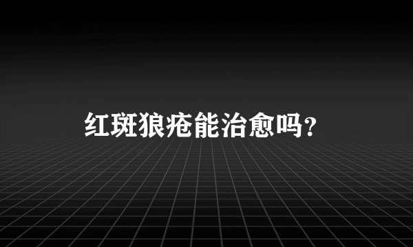 红斑狼疮能治愈吗？