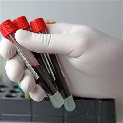 急性白血病能治好吗