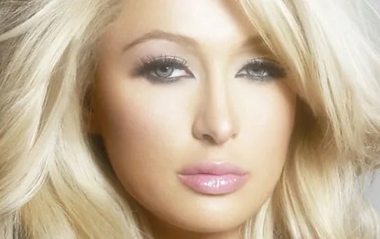 北京自体脂肪填充法令纹大概价格