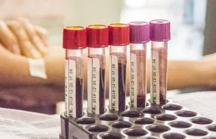 万能血！江苏发现2例全球罕见黄金血型，拥有这种血型是一种什么体验？