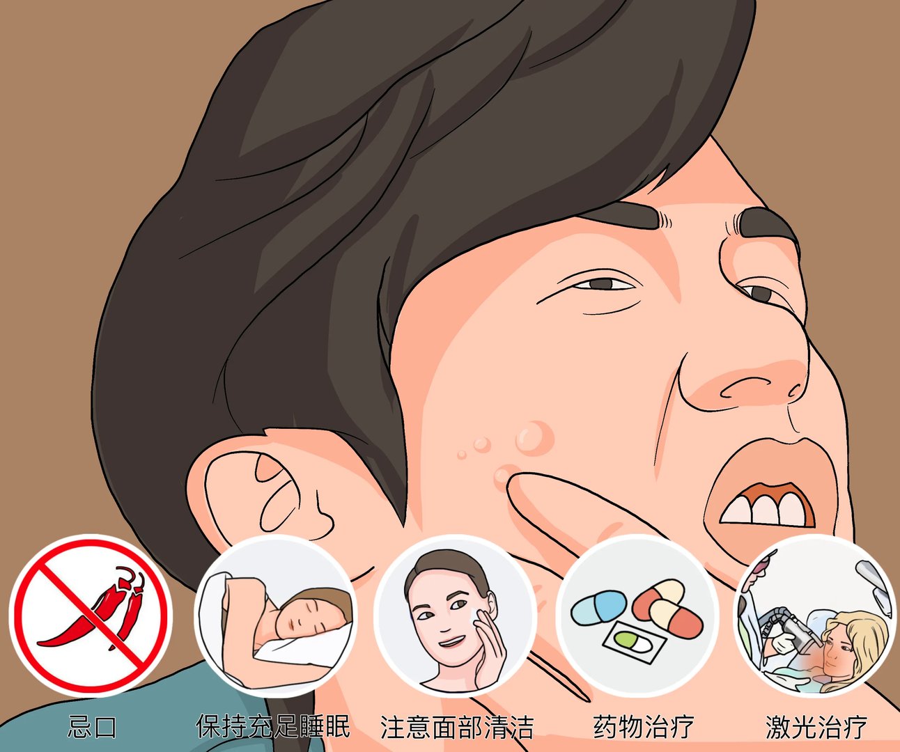 长痘痘怎么处理