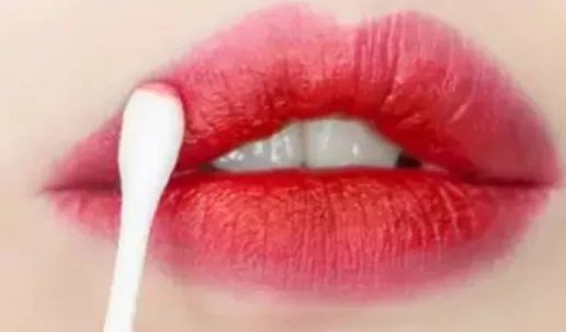 玻尿酸丰唇珠有哪些不良反应