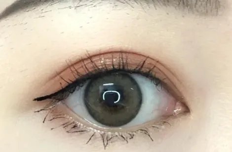 韩式三点定位双眼皮多少钱