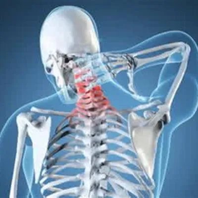 脊髓型颈椎病是怎么回事?