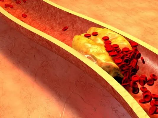 胆囊壁毛糙怎么办