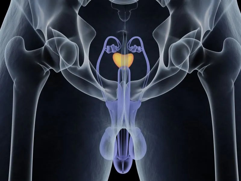 前列腺大如何治疗