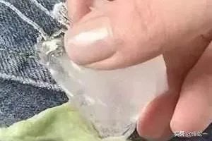 口香糖粘在衣物上如何弄掉？