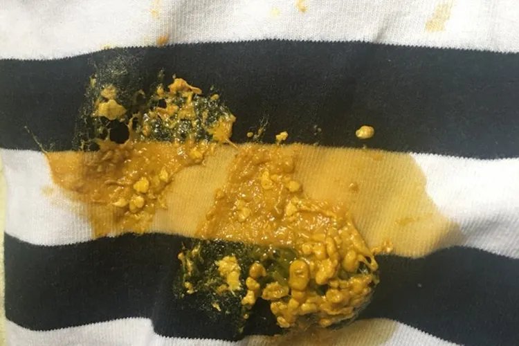 新生儿便便图片分析