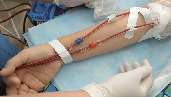 献血的好处有哪些