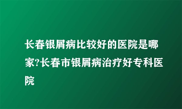 长春银屑病比较好的医院是哪家?长春市银屑病治疗好专科医院