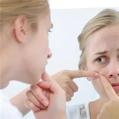 黑头粉刺是什么