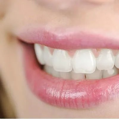 牙齿矫正哪个好