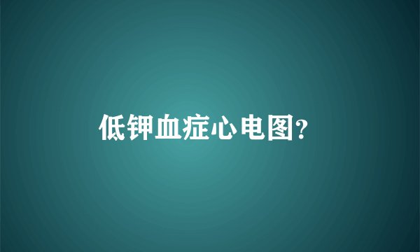 低钾血症心电图？