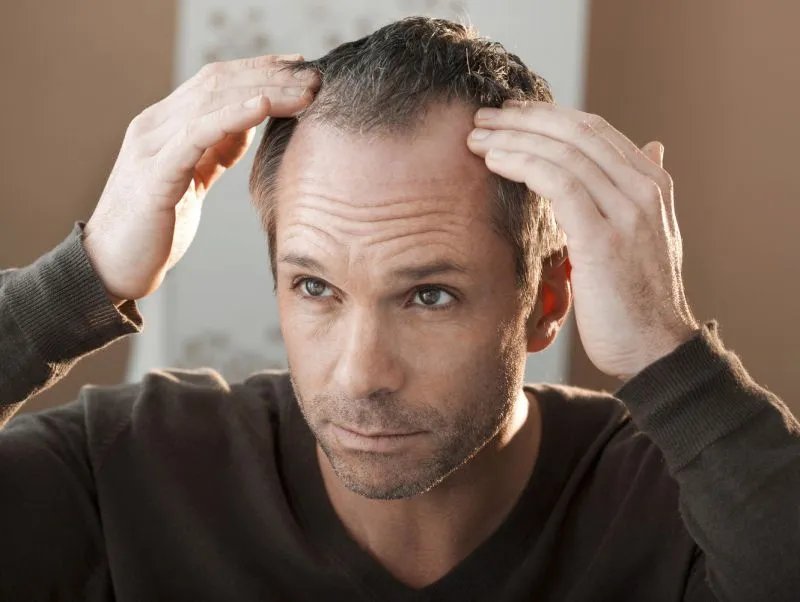 突然掉头发很厉害怎么办