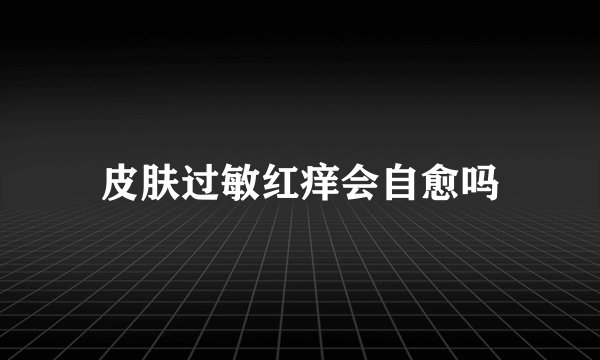 皮肤过敏红痒会自愈吗
