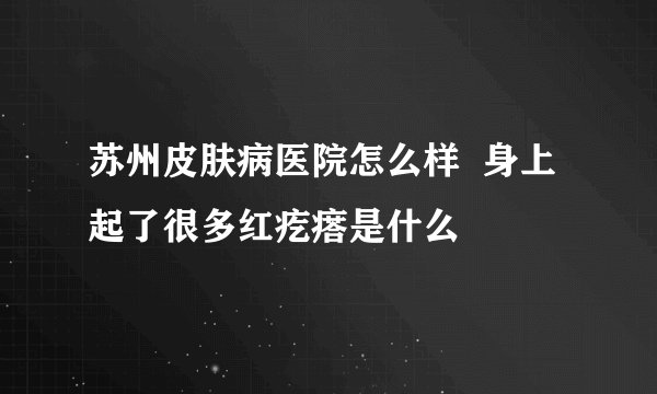 苏州皮肤病医院怎么样  身上起了很多红疙瘩是什么
