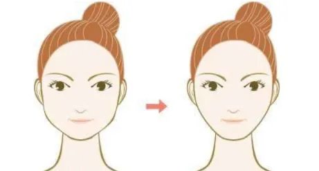 做削骨手术后遗症