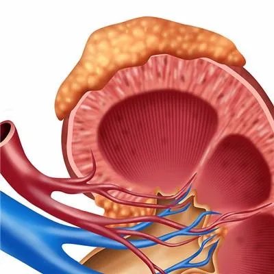 急性肾功能不全是怎么回事