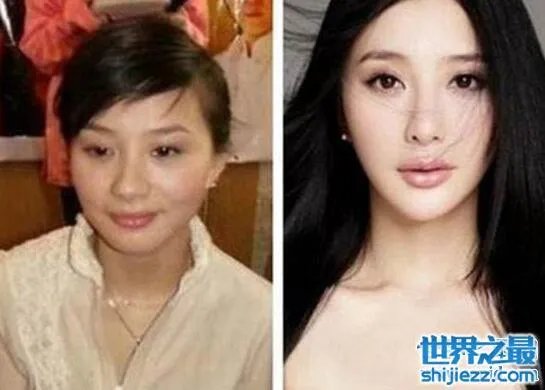 熊乃瑾整容前后照片对比，清新女神整容失败香肠嘴 