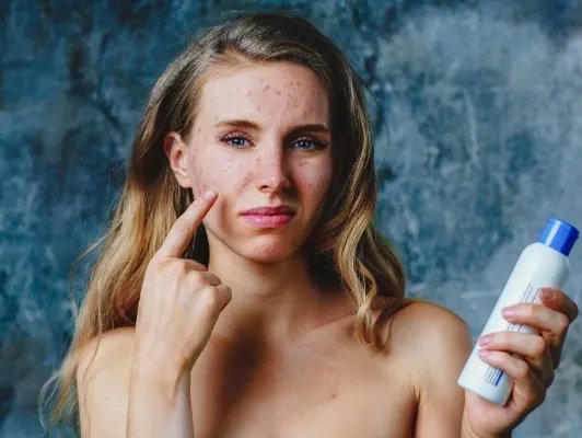 面部过敏怎么办