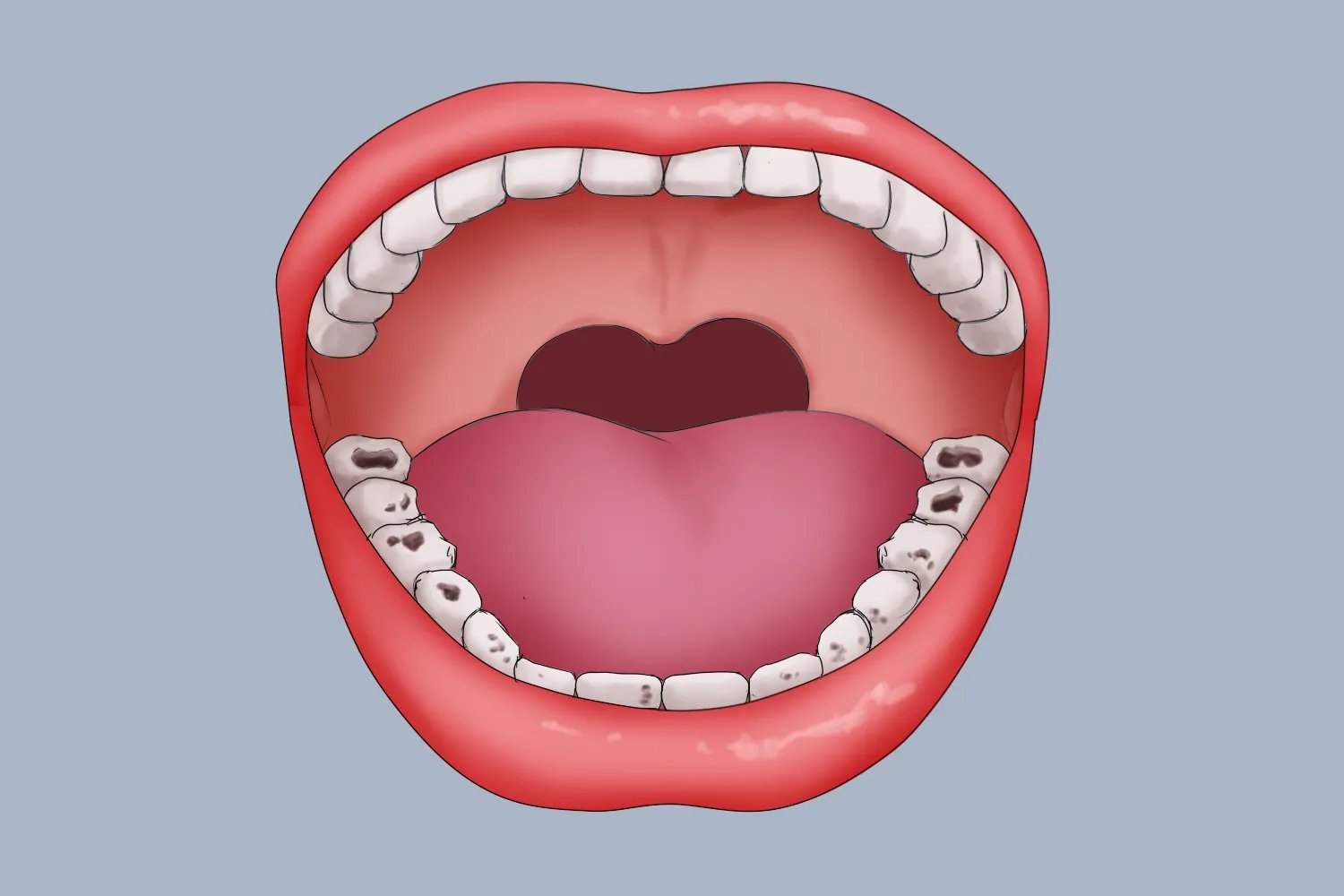 蛀牙图片儿童卡通图片