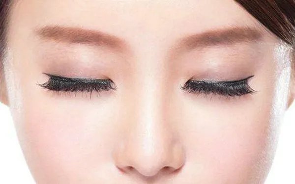 隆鼻假体取出多少钱？