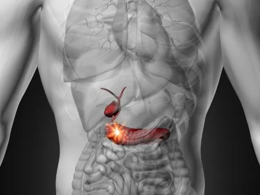 慢性胰腺炎的症状