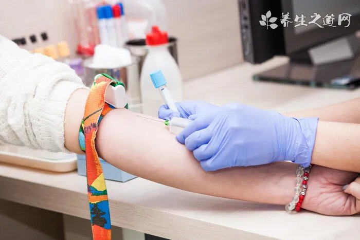 乌龟白眼病症状 乌龟白眼病发病及防治的方法