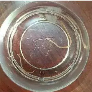 女子洗澡时从花洒冲出红色活虫，蜷缩扭动形似蚯蚓，对身体是否会有伤害？