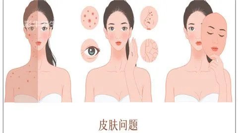 面部去痣的方法