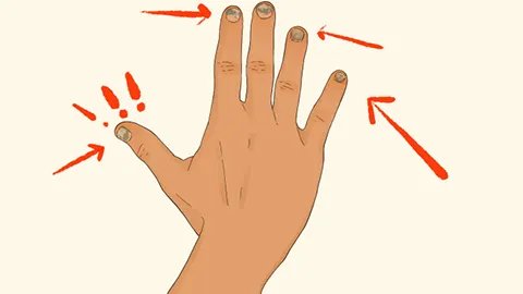 健康的指甲是什么样的