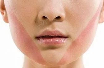 下巴吸脂多久可以恢复