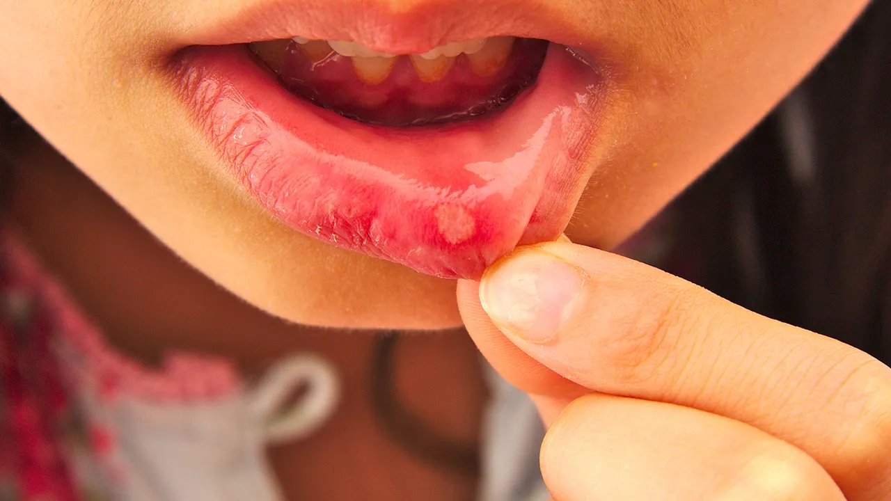 促进肝细胞生长素的疗效