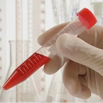 伽玛刀治疗肝癌怎么样