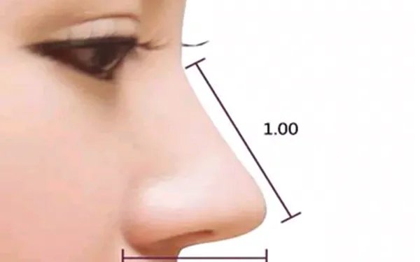 做歪鼻矫正手术需要多少钱