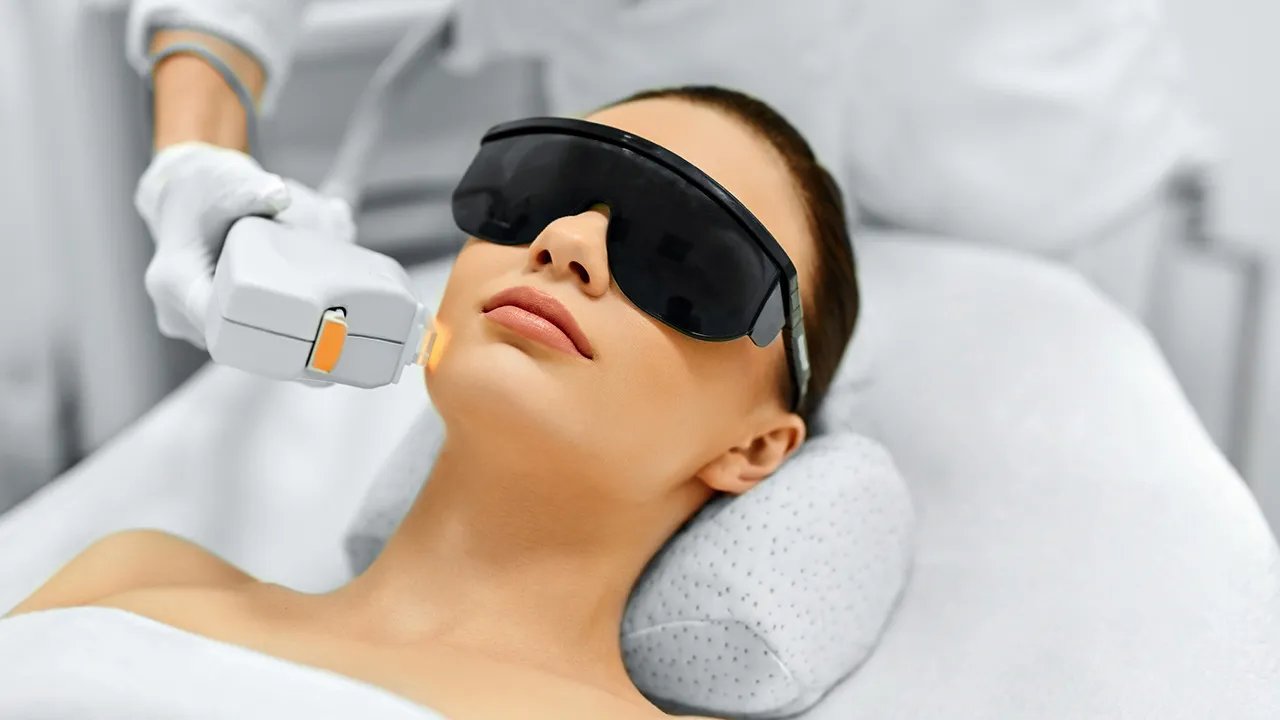 光子嫩肤的好处