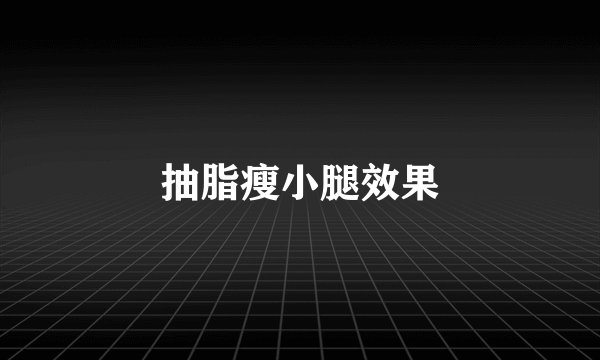 抽脂瘦小腿效果