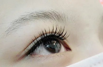 开眼角割双眼皮多少钱