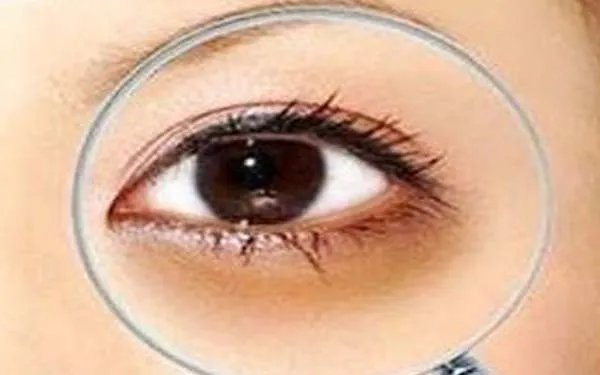 北京哪个医院激光去眼袋好？