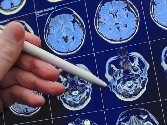 后脑勺疼痛是怎么回事