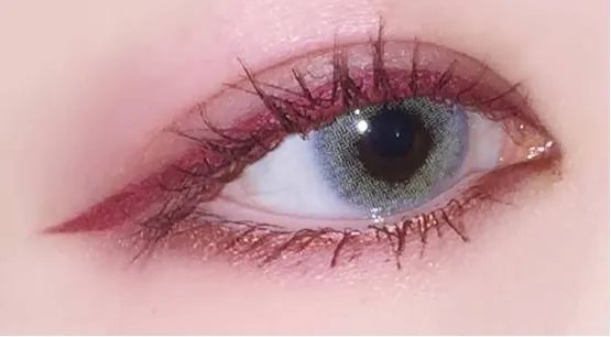 双眼皮手术要多少钱啊