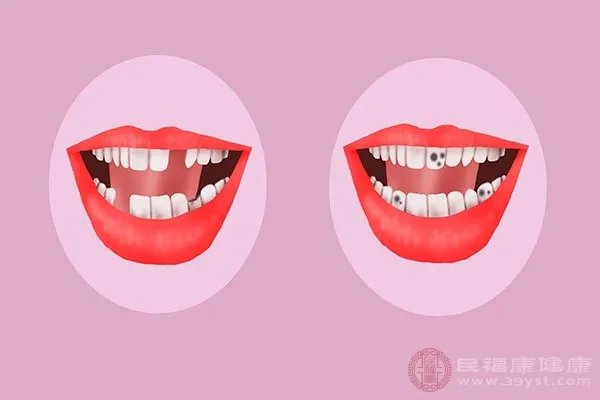 智齿拔还是不拔