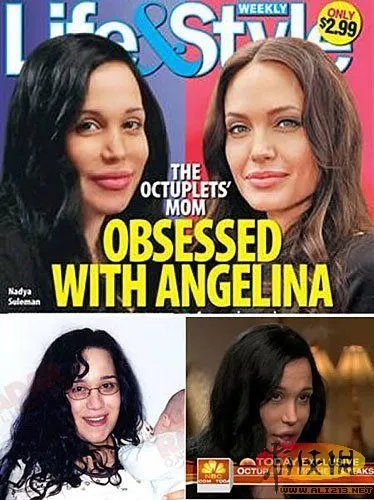 女子隆胸失败跳楼 盘点那些整容成痴的奇葩们