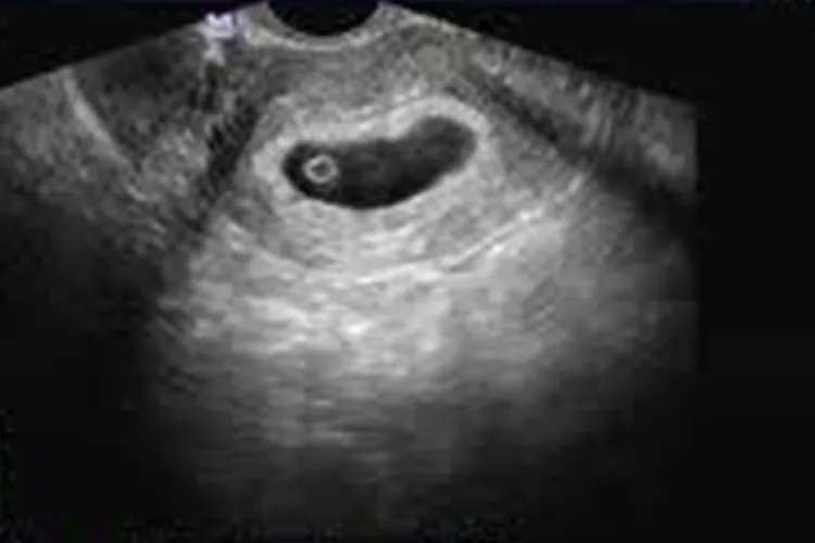 怀孕50天胎儿是什么样子图片