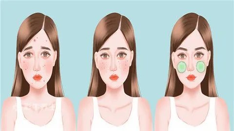 面部去痣的方法