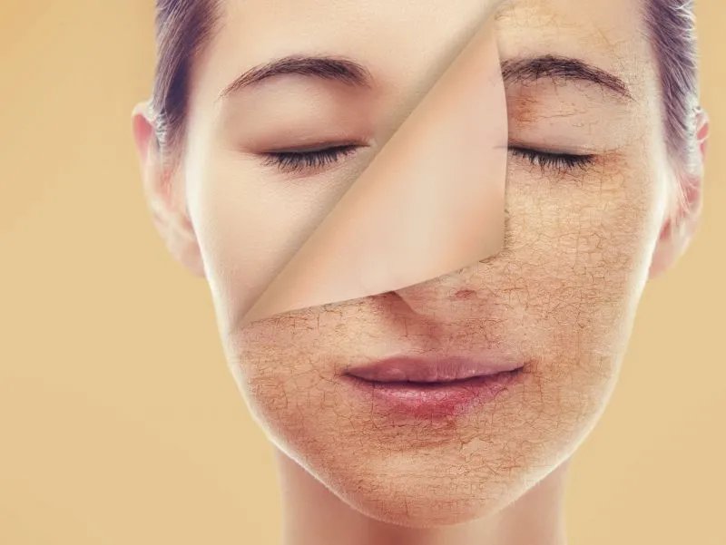 身上皮肤粗糙怎么办