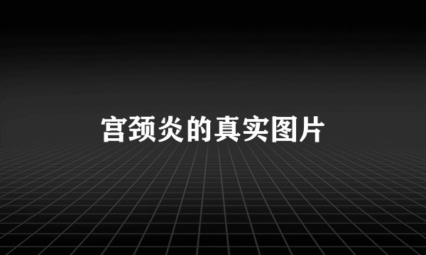 宫颈炎的真实图片