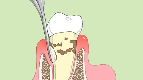 正常人牙齿多少颗