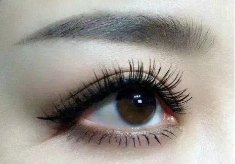 重庆做双眼皮价格